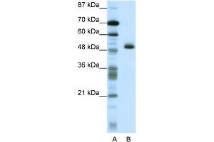 WB Suggested Anti-ZNF213 Antibody Titration:  1. (ZNF213 Antikörper  (N-Term))
