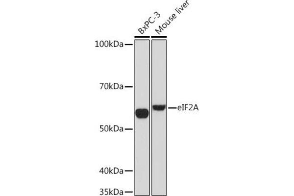 EIF2A Antikörper