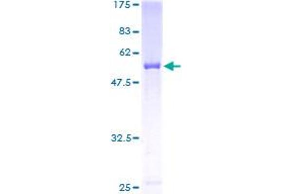 CLIC2 Protein (AA 1-247) (GST tag)