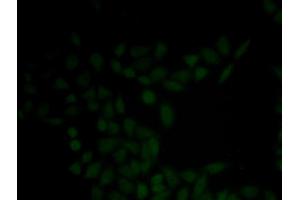 Immunofluorescence analysis of HeLa cell using KRT5 antibody (Cytokeratin 5 Antikörper)
