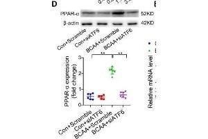 BCAA increase PPAR-α expression in a GCN2/ATF6 pathway-dependent manner. (beta Actin Antikörper)