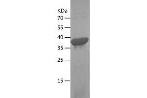 Western Blotting (WB) image for DIS3-Like Exonuclease 2 (DIS3L2) (AA 32-172) protein (His-IF2DI Tag) (ABIN7122676) (DIS3L2 Protein (AA 32-172) (His-IF2DI Tag))