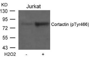 Western blot analysis of extracts from Jurkat cells untreated or treated with H2O2 using Cortactin(Phospho-Tyr466) Antibody. (Cortactin Antikörper  (pTyr466))