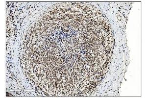 IHC analysis of SUMO2/3 using anti-SUMO2/3 antibody (ABIN7600856). (SUMO2/3 Antikörper  (AA 24-72))