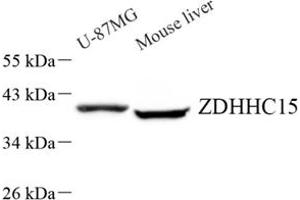 Western blot analysis of ZDHHC15 (ABIN7076280) at dilution of 1: 500