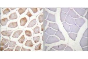 Immunohistochemistry analysis of paraffin-embedded human skeletal muscle, using DAPK2 (Phospho-Ser318) Antibody. (DAPK2 Antikörper  (pSer318))