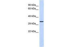 Image no. 1 for anti-Ventral Anterior Homeobox 1 (VAX1) (N-Term) antibody (ABIN6740506) (VAX1 Antikörper  (N-Term))