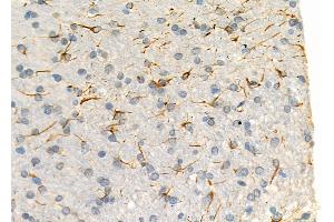 ABIN6266253 and ABIN6277443 at 1/100 staining Rat brain tissue by IHC-P. (MYSM1 Antikörper  (Internal Region))