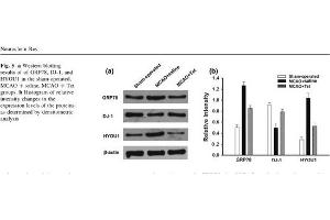 Rat brain lysates probed with Rabbit Anti-ORP150 Polyclonal Antibody (HYOU1 Antikörper  (AA 401-500))