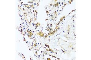 Immunohistochemistry of paraffin-embedded human lung using B antibody (ABIN7265851) at dilution of 1:100 (40x lens). (BAG3 Antikörper  (AA 380-575))