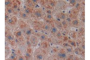 DAB staining on IHC-P; Samples: Human Liver Tissue (CENPE Antikörper  (AA 2450-2590))