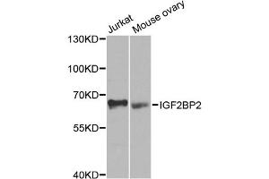 Western blot analysis of extracts of various cell lines, using IGF2BP2 antibody (ABIN5971464) at 1/1000 dilution. (IGF2BP2 Antikörper)