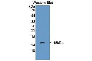 Western Blotting (WB) image for anti-Complement Factor B (CFB) (AA 476-592) antibody (ABIN1858374) (Complement Factor B Antikörper  (AA 476-592))