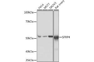 Western blot analysis of extracts of various cell lines, using SFRP4 Rabbit mAb (ABIN7270180) at 1:1000 dilution. (SFRP4 Antikörper)