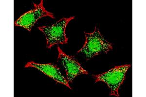 Fluorescent confocal image of HeLa cells stained with Natriuretic Peptide Receptor C (N-term) antibody.