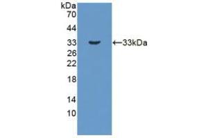 Figure. (HSD17B3 Antikörper  (AA 1-310))