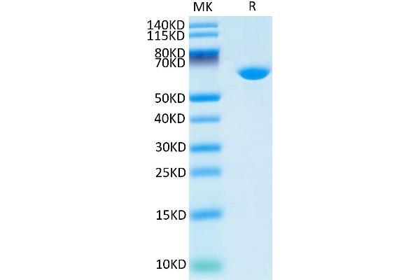 Albumin Protein (ALB) (AA 25-608) (His tag)