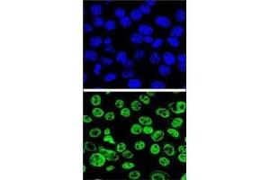 Confocal immunofluorescent analysis of MDM2 antibody with HeLa cells followed by Alexa Fluor 488-conjugated goat anti-rabbit lgG (green). (MDM2 Antikörper  (AA 141-176))