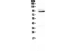 Western blot analysis of PTPN22 using anti-PTPN22 antibody . (PTPN22 Antikörper  (AA 1-309))