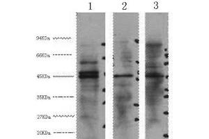 Western Blot analysis of 1) Hela, 2) Jurkat, 3) 293T cells using ENO2 Monoclonal Antibody at dilution of 1:3000. (ENO2/NSE Antikörper)