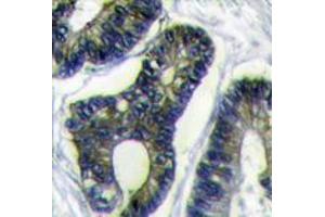 Image no. 3 for anti-Finkel-Biskis-Reilly Murine Sarcoma Virus (FBR-MuSV) Ubiquitously Expressed (FAU) (C-Term) antibody (ABIN357136) (FAU Antikörper  (C-Term))