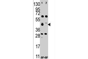 Western blot analysis of FDFT1 polyclonal antibody  in A-375 cell line lysate . (FDFT1 Antikörper  (Internal Region))