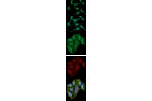 ICC/IF analysis of S100A4 in A549 cells line, stained with DAPI (Blue) for nucleus staining and monoclonal anti-human S100A4 antibody (1:100) with goat anti-mouse IgG-Alexa fluor 488 conjugate (Green).