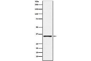 Western blot analysis of KLK2 expression in MOLT4 cell lysate.