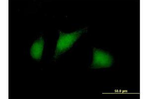 Immunofluorescence of purified MaxPab antibody to TSC22D1 on HeLa cell. (TSC22D1 Antikörper  (AA 1-144))
