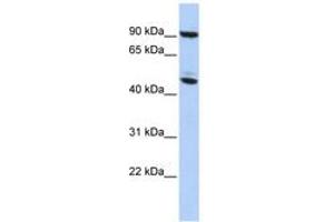 Image no. 1 for anti-Methyl CpG Binding Protein 2 (MECP2) (AA 35-84) antibody (ABIN6742304) (MECP2 Antikörper  (AA 35-84))