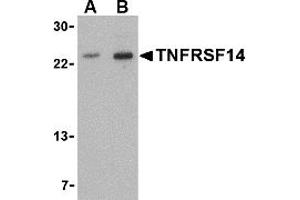 Western Blotting (WB) image for anti-Tumor Necrosis Factor Receptor Superfamily, Member 14 (TNFRSF14) (N-Term) antibody (ABIN1031632) (HVEM Antikörper  (N-Term))