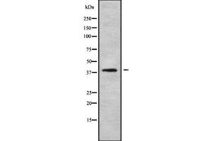 Western blot analysis of PDCD2 using LOVO whole cell lysates (PDCD2 Antikörper  (N-Term))