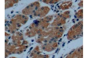 Immunohistochemistry (IHC) image for anti-Keratin 8 (KRT8) (AA 92-393) antibody (ABIN7434548)