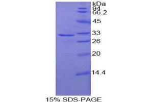 SDS-PAGE analysis of Human Contactin 4 Protein.