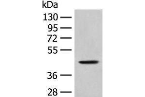 Western blot analysis of A549 cell lysate using HLA-B Polyclonal Antibody at dilution of 1:400 (HLA-B Antikörper)