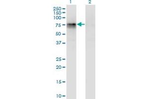 Western Blot analysis of CBFA2T2 expression in transfected 293T cell line by CBFA2T2 monoclonal antibody (M05), clone 3A2.
