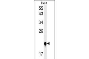 Western blot analysis of I Antibody (C-term)&65288,Cat(ABIN653856 and ABIN2843116)) in Hela cell line lysates (35 μg/lane). (IMP3 Antikörper  (C-Term))