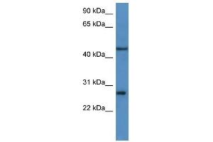 Western Blot showing FGFBP2 antibody used at a concentration of 1-2 ug/ml to detect its target protein. (FGFBP2 Antikörper  (C-Term))
