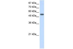 WB Suggested Anti-YARS Antibody Titration:  2. (YARS Antikörper  (C-Term))