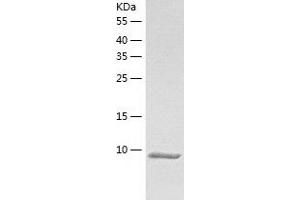 Western Blotting (WB) image for Calcium/calmodulin-Dependent Protein Kinase II Inhibitor 1 (CAMK2N1) (AA 1-78) protein (His tag) (ABIN7122094)