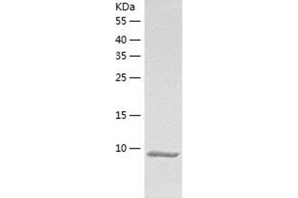 CAMK2N1 Protein (AA 1-78) (His tag)