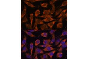 Immunofluorescence (IF) image for anti-Malic Enzyme 3, NADP(+)-Dependent, Mitochondrial (ME3) (AA 505-604) antibody (ABIN7268384)