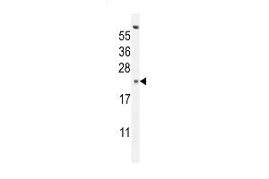 GAGE13 Antibody (N-term) (ABIN654525 and ABIN2844247) western blot analysis in K562 cell line lysates (35 μg/lane). (G Antigen 13 Antikörper  (N-Term))