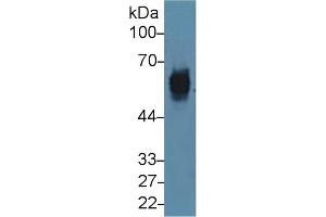 Detection of CK5 in Mouse Skin lysate using Polyclonal Antibody to Cytokeratin 5 (CK5) (Cytokeratin 5 Antikörper  (AA 163-471))
