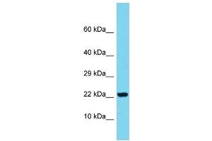 Host: Rabbit Target Name: SAPCD1 Sample Type: Fetal Kidney lysates Antibody Dilution: 1.
