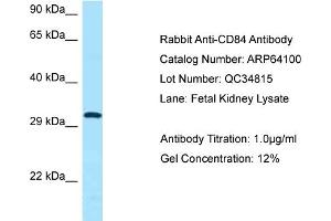 Western Blotting (WB) image for anti-CD84 (CD84) (C-Term) antibody (ABIN2789730) (CD84 Antikörper  (C-Term))