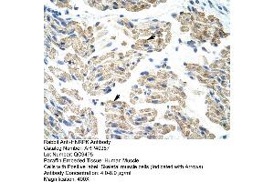 Rabbit Anti-HNRPK Antibody  Paraffin Embedded Tissue: Human Skeletal Muscle Cellular Data: Skeletal muscle  Antibody Concentration: 4. (HNRNPK Antikörper  (C-Term))