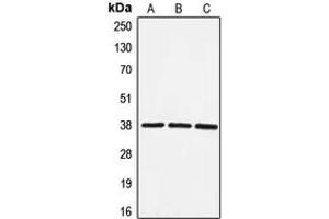 Western blot analysis of EIF3F expression in HeLa (A), HepG2 (B), NIH3T3 (C) whole cell lysates. (EIF3F Antikörper  (Center))