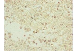 Immunohistochemistry (IHC) image for anti-TAM41, Mitochondrial Translocator Assembly and Maintenance Protein (TAMM41) (AA 161-452) antibody (ABIN7163117)