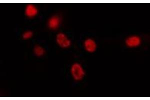 ABIN6274426 staining HepG2 cells by IF/ICC. (SPIC Antikörper  (Internal Region))